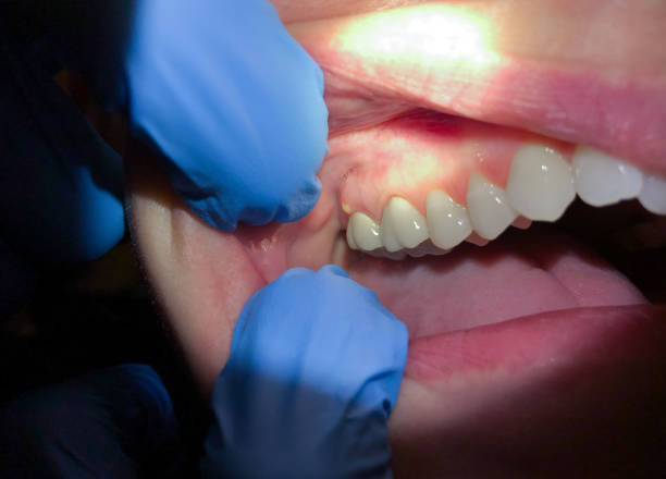 Trusted VA Emergency Dental Service Experts