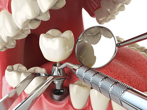 Best Walk-In Emergency Dental Services in Blackstone, VA